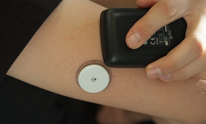A continuous glucose sensor worn on the upper arm